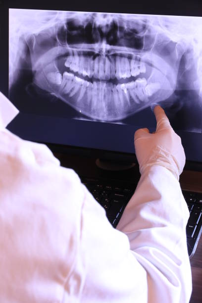 Best Emergency Root Canal Therapy in Johnson Creek, WI