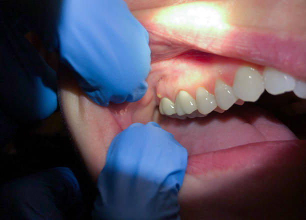 Best Walk-In Emergency Dental Services in Johnson Creek, WI