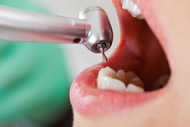 Best Emergency Root Canal Therapy in Johnson Creek, WI